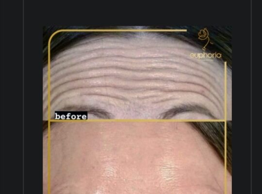 ايفوريا كلينك Euphoria clinic