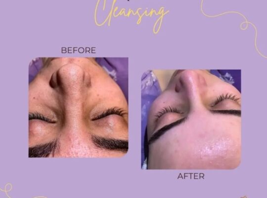 ايفوريا كلينك Euphoria clinic