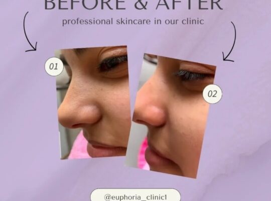 ايفوريا كلينك Euphoria clinic