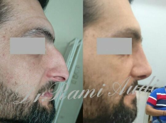 د. رامي عودة