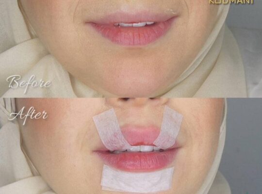 عيادة قضماني- Kodmani Beauty