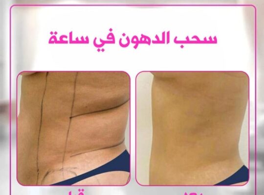 مركز سيف بيوتي- Sefi beauty