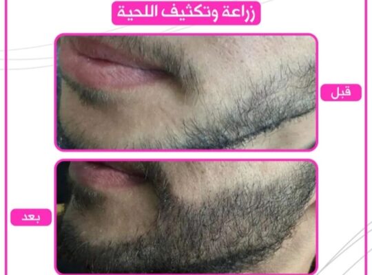 مركز سيف بيوتي- Sefi beauty