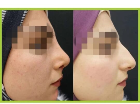 مركز لتين الطبي-د. سمير شاليش حسن