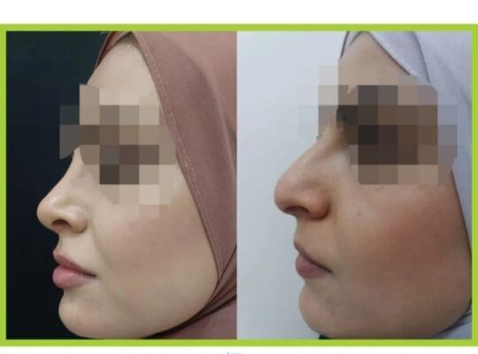 مركز لتين الطبي-د. سمير شاليش حسن