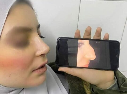 الدكتور كنان شريفه _ تجميل الأنف والوجه