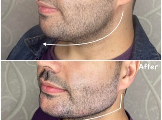 د. علاء سليمان