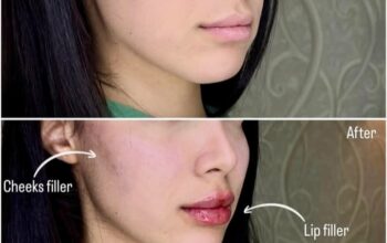 د. علاء سليمان