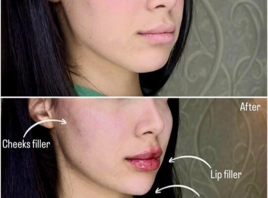 د. علاء سليمان