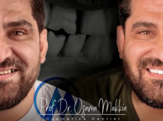 د. أسامة مكية- Dr.Osama Makkia