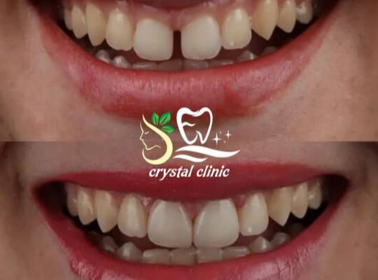 مركز كريستال الطبي