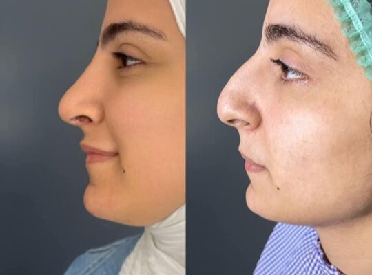 الدكتور حسان ديوب ـ Dr.Hassan Dayoub