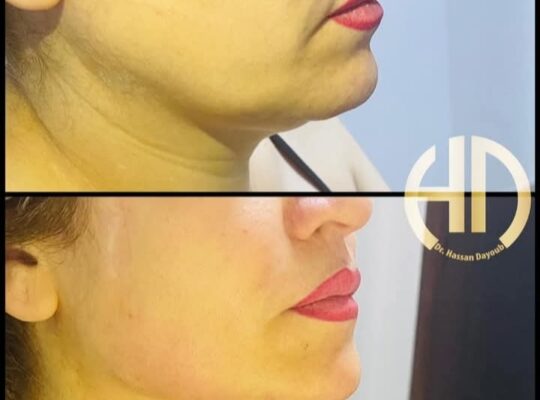 الدكتور حسان ديوب ـ Dr.Hassan Dayoub