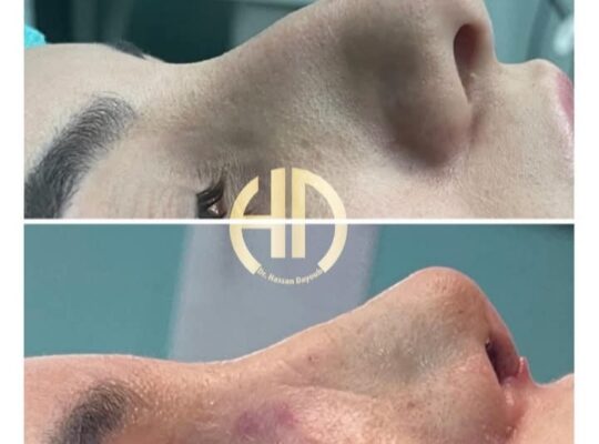 الدكتور حسان ديوب ـ Dr.Hassan Dayoub