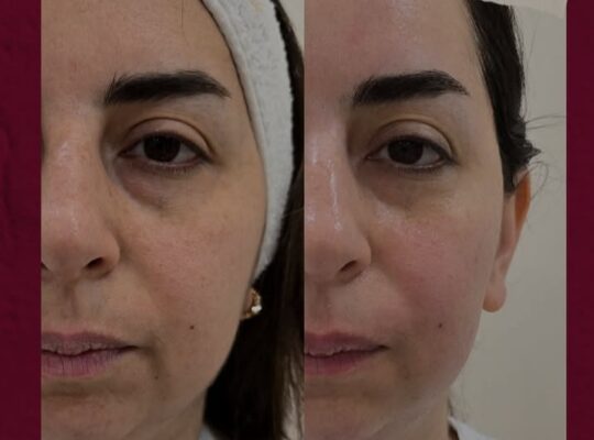 عيادة الدكتورة هبة محفوظ حموية للتجميل والليزر