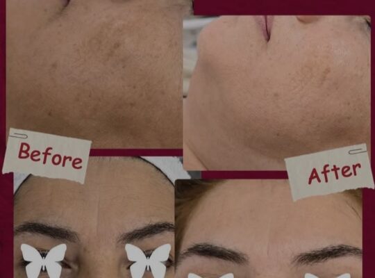 عيادة الدكتورة هبة محفوظ حموية للتجميل والليزر