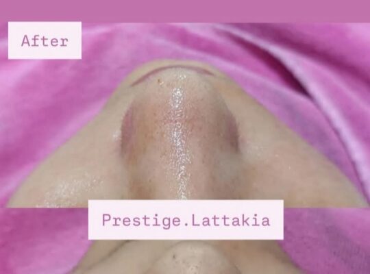 مركز بريستيج _ Prestige Beauty Centre