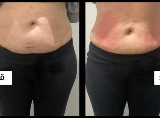 مركز بريستيج _ Prestige Beauty Centre