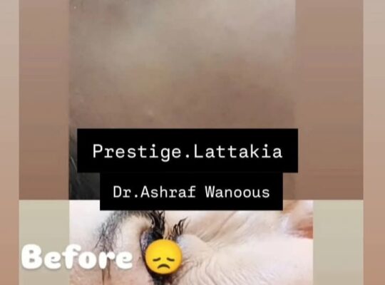 مركز بريستيج _ Prestige Beauty Centre