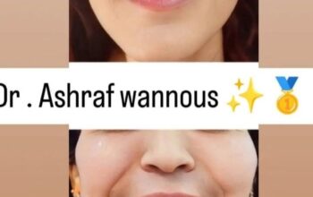 مركز بريستيج _ Prestige Beauty Centre