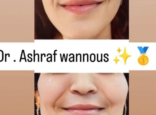 مركز بريستيج _ Prestige Beauty Centre