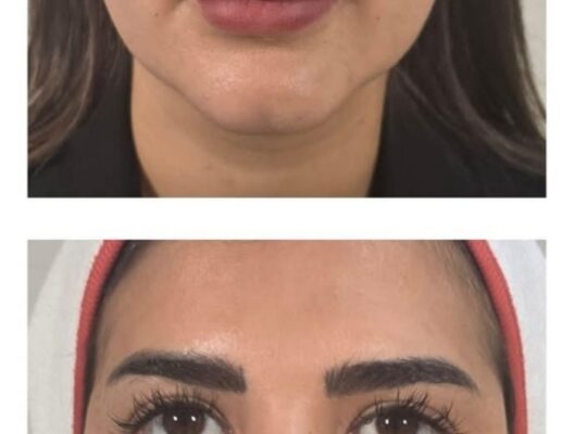 عيادة الدكتورة دعاء كروم الجلدية والتجميلية