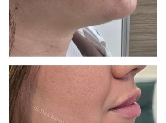 عيادة الدكتورة دعاء كروم الجلدية والتجميلية