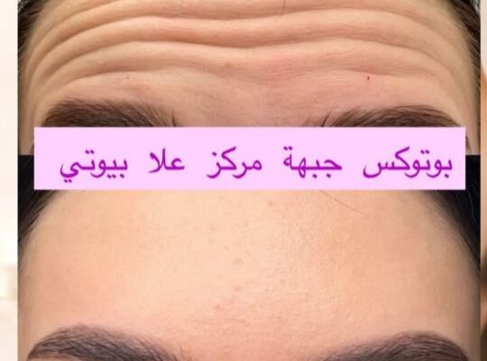 مركز علا بيوتي _ Ola beauty