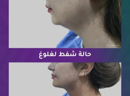 عيادات أفروديت _ Aphrodite clinic