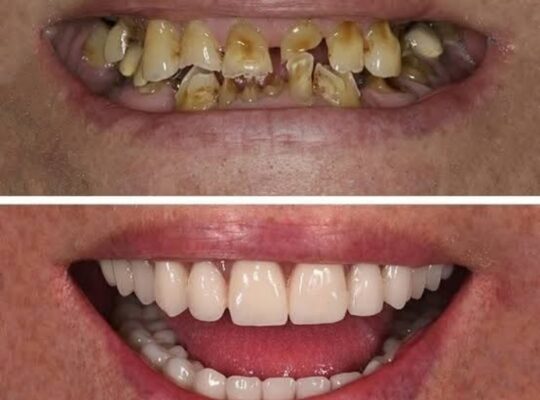 العيادات الملكية البريطانية