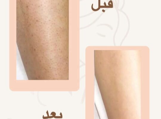 مركز ريفا بيوتي _ Reva Beauty Centre