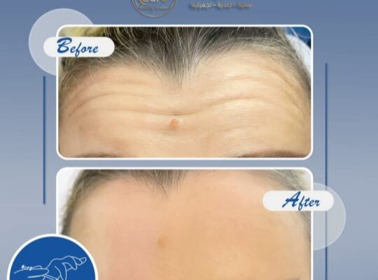 مركز لور التجميلي _ Laure Beauty Centr