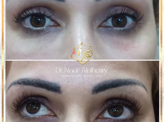 د. نور النيجاوي _ Nour Alnihawy Clinic