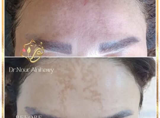 د. نور النيجاوي _ Nour Alnihawy Clinic