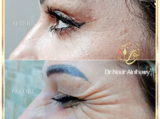 د. نور النيجاوي _ Nour Alnihawy Clinic