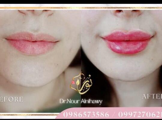 د. نور النيجاوي _ Nour Alnihawy Clinic