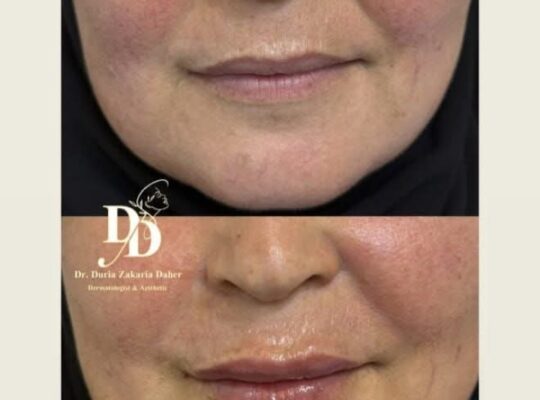 مركز غلو الطبي للعناية والتجميل