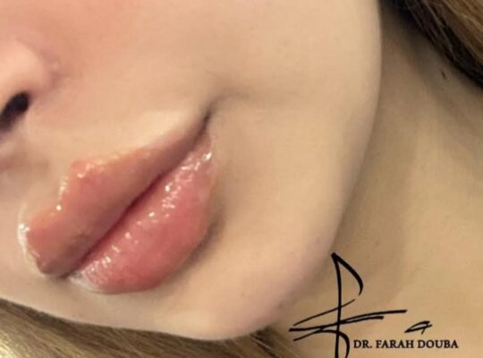 الدكتورة فرح محمد دوبا