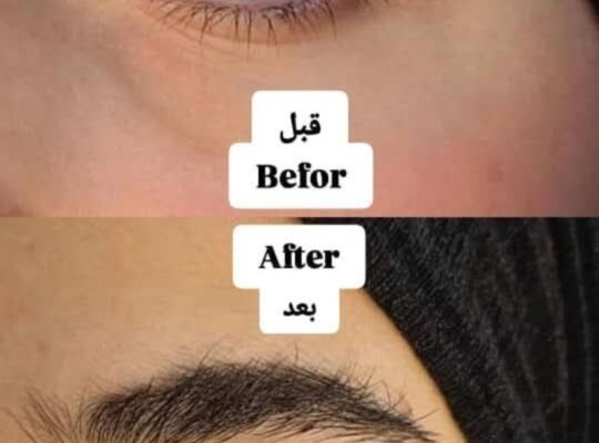 مركز تجميل RS لتجميل السيدات