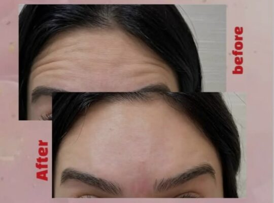 عيادة بانه للتجميل