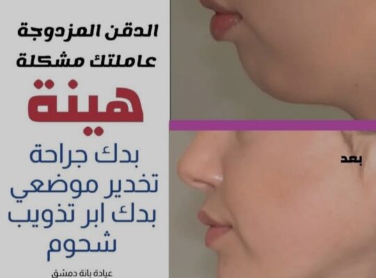 عيادة بانه للتجميل