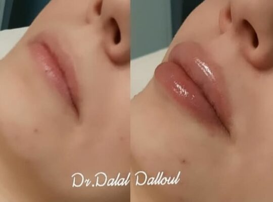 الدكتورة دلال دللول