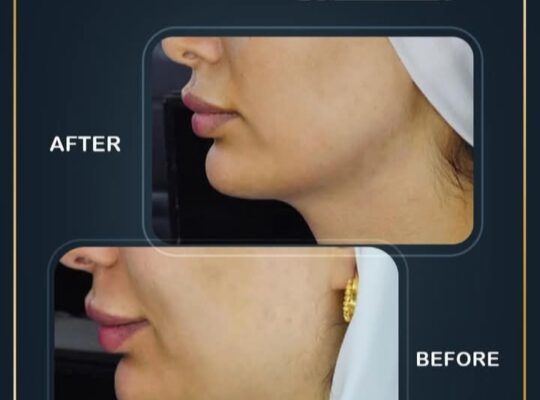 الدكتور كنان محسن: العيادة الإذنية التجميلية