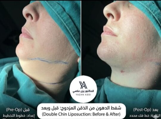 الدكتور يزن عاصي اخصائي أنف إذن حنجرة