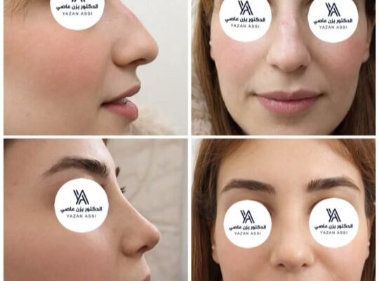 الدكتور يزن عاصي اخصائي أنف إذن حنجرة