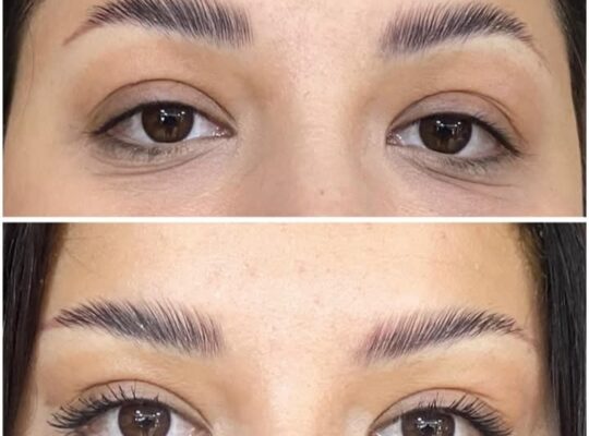 الدكتور بشير خرفان جراحة وتجميل الرأس والعنق