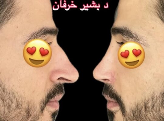 الدكتور بشير خرفان جراحة وتجميل الرأس والعنق