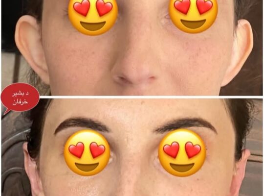 الدكتور بشير خرفان جراحة وتجميل الرأس والعنق