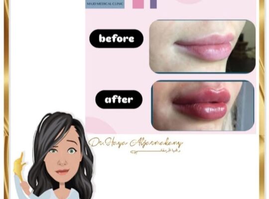 الدكتورة هيا الجرمقاني