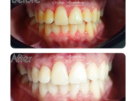 الدكتورة هيا الجرمقاني